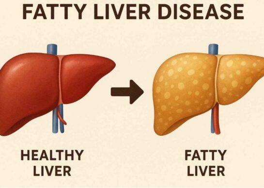 Common Liver Diseases